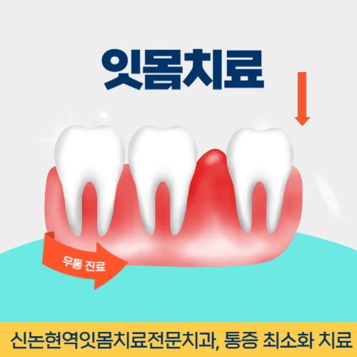 통영치과 통영시 치과 잇몸치료